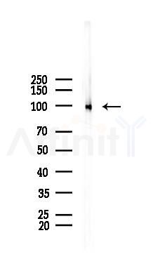 Phospho-LPIN1 (Thr14) Mouse Monoclonal Antibody - Western blot analysis of lysates from K562 cells(heat-shock 45min treatment), using Phospho-LPIN1 (Thr14) Mouse Monoclonal Antibody at 1/1000 dilution.
