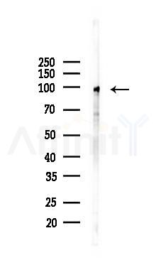 Phospho-LPIN1 (Thr14) Mouse Monoclonal Antibody - Western blot analysis of lysates from Hela cells(UV 30min treatment), using Phospho-LPIN1 (Thr14) Mouse Monoclonal Antibody at 1/1000 dilution.