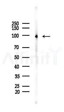 Phospho-LPIN1 (Thr14) Mouse Monoclonal Antibody - Western blot analysis of lysates from B16F10-LUC cells(LPS 4h treatment), using Phospho-LPIN1 (Thr14) Mouse Monoclonal Antibody at 1/1000 dilution.