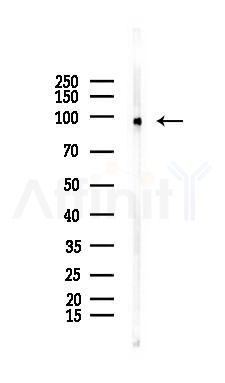 Phospho-LPIN1 (Thr14) Mouse Monoclonal Antibody - Western blot analysis of lysates from PC12 cells(starvation 24h treatment), using Phospho-LPIN1 (Thr14) Mouse Monoclonal Antibody at 1/1000 dilution.