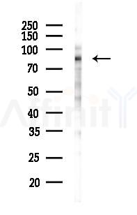 Phospho-FRS2 (Tyr436) Mouse Monoclonal Antibody - Western blot analysis of lysates from B16F10-LUC cells(LPS 4h treatment), using Phospho-FRS2 (Tyr436) Mouse Monoclonal Antibody at 1/1000 dilution.