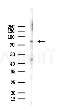 Phospho-FRS2 (Tyr436) Mouse Monoclonal Antibody - Western blot analysis of lysates from PC12 cells(starvation 24h treatment), using Phospho-FRS2 (Tyr436) Mouse Monoclonal Antibody at 1/1000 dilution.