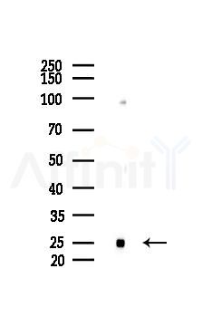 RPL13 Mouse Monoclonal Antibody - Western blot analysis of lysates from 293 cells(heat-shock 45min treatment), using RPL13 Mouse Monoclonal Antibody at 1/1000 dilution.