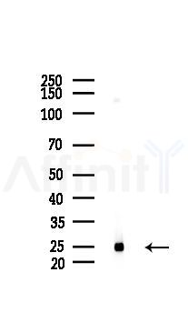 RPL13 Mouse Monoclonal Antibody - Western blot analysis of lysates from COLO205 cells(UV 30min treatment), using RPL13 Mouse Monoclonal Antibody at 1/1000 dilution.