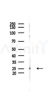 RPL13 Mouse Monoclonal Antibody - Western blot analysis of lysates from Rat liver, using RPL13 Mouse Monoclonal Antibody at 1/1000 dilution.