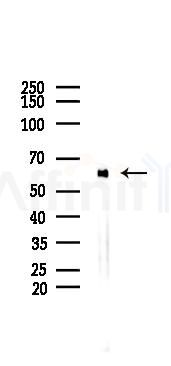 Spastin Mouse Monoclonal Antibody - Western blot analysis of lysates from 293 cells(heat-shock 45min treatment), using Spastin Mouse Monoclonal Antibody at 1/1000 dilution.
