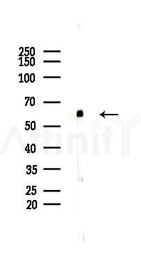 Spastin Mouse Monoclonal Antibody - Western blot analysis of lysates from COLO205 cells(UV 30min treatment), using Spastin Mouse Monoclonal Antibody at 1/1000 dilution.