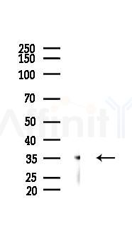 EFHD2 Mouse Monoclonal Antibody - Western blot analysis of lysates from PC12 cells(starvation 24h treatment), using EFHD2 Mouse Monoclonal Antibody at 1/1000 dilution.