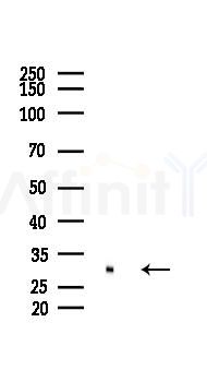 EFHD2 Mouse Monoclonal Antibody - Western blot analysis of lysates from COLO205 cells(UV 30min treatment), using EFHD2 Mouse Monoclonal Antibody at 1/1000 dilution.