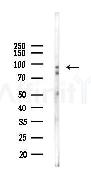 PARP9 Mouse Monoclonal Antibody - Western blot analysis of lysates from A2780 cells(LPS 4h treatment), using PARP9 Mouse Monoclonal Antibody at 1/1000 dilution.