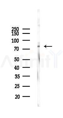 PARP9 Mouse Monoclonal Antibody - Western blot analysis of lysates from PC12 cells(starvation 24h treatment), using PARP9 Mouse Monoclonal Antibody at 1/1000 dilution.