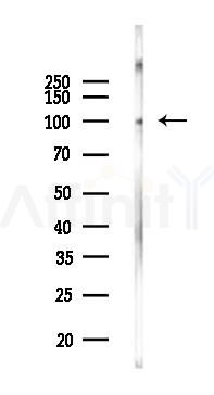 PARP9 Mouse Monoclonal Antibody - Western blot analysis of lysates from Mouse testis, using PARP9 Mouse Monoclonal Antibody at 1/1000 dilution.