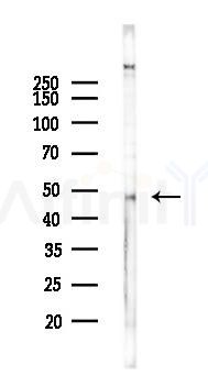 FOXA2 Mouse Monoclonal Antibody - Western blot analysis of lysates from HUVEC cells(LPS 4h treatment), using FOXA2 Mouse Monoclonal Antibody at 1/1000 dilution.