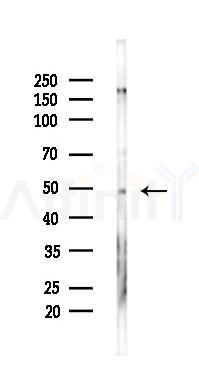 FOXA2 Mouse Monoclonal Antibody - Western blot analysis of lysates from Hela cells(UV 30min treatment), using FOXA2 Mouse Monoclonal Antibody at 1/1000 dilution.