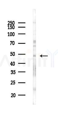 FOXA2 Mouse Monoclonal Antibody - Western blot analysis of lysates from 293 cells(heat-shock 45min treatment), using FOXA2 Mouse Monoclonal Antibody at 1/1000 dilution.