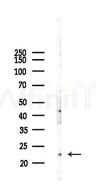SM22 alpha Mouse Monoclonal Antibody - Western blot analysis of lysates from Hela cells(UV 30min treatment), using SM22 alpha Mouse Monoclonal Antibody at 1/1000 dilution.