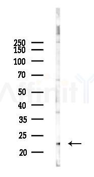 SM22 alpha Mouse Monoclonal Antibody - Western blot analysis of lysates from COLO205 cells(UV 30min treatment), using SM22 alpha Mouse Monoclonal Antibody at 1/1000 dilution.