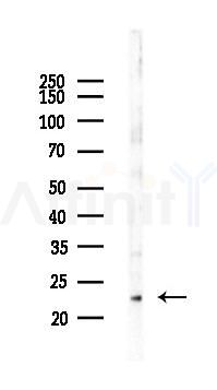 SM22 alpha Mouse Monoclonal Antibody - Western blot analysis of lysates from Rat testis, using SM22 alpha Mouse Monoclonal Antibody at 1/1000 dilution.