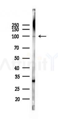 TRPV4 Mouse Monoclonal Antibody - Western blot analysis of lysates from Hela cells(UV 30min treatment), using TRPV4 Mouse Monoclonal Antibody at 1/1000 dilution.