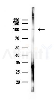 TRPV4 Mouse Monoclonal Antibody - Western blot analysis of lysates from 293 cells(heat-shock 45min treatment), using TRPV4 Mouse Monoclonal Antibody at 1/1000 dilution.