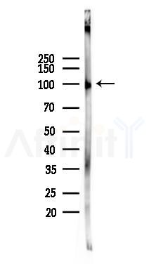 TRPV4 Mouse Monoclonal Antibody - Western blot analysis of lysates from Rat lung, using TRPV4 Mouse Monoclonal Antibody at 1/1000 dilution.