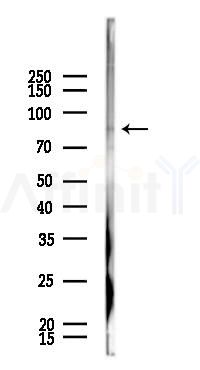 Hsp90 alpha Mouse Monoclonal Antibody - Western blot analysis of lysates from HepG2 cells(heat-shock 45min treatment), using Hsp90 alpha Mouse Monoclonal Antibody at 1/1000 dilution.
