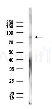 Hsp90 alpha Mouse Monoclonal Antibody - Western blot analysis of lysates from HepG2 cells(heat-shock 45min treatment), using Hsp90 alpha Mouse Monoclonal Antibody at 1/1000 dilution.