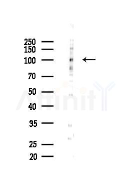 UBE3A Mouse Monoclonal Antibody - Western blot analysis of lysates from HUVEC cells(LPS 4h treatment), using UBE3A Mouse Monoclonal Antibody at 1/1000 dilution.