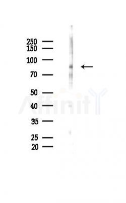 UBE3A Mouse Monoclonal Antibody - Western blot analysis of lysates from Mouse brain, using UBE3A Mouse Monoclonal Antibody at 1/1000 dilution.