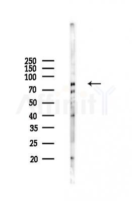 ZBED1 Mouse Monoclonal Antibody - Western blot analysis of lysates from K562 cells(heat-shock 45min treatment), using ZBED1 Mouse Monoclonal Antibody at 1/1000 dilution.