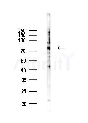 ZBED1 Mouse Monoclonal Antibody - Western blot analysis of lysates from A2780 cells(LPS 4h treatment), using ZBED1 Mouse Monoclonal Antibody at 1/1000 dilution.