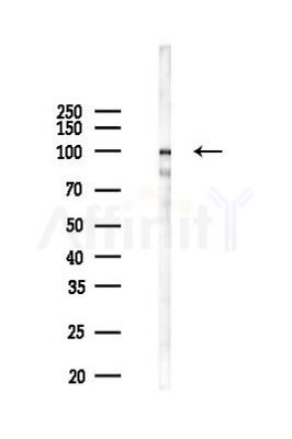 RBM25 Mouse Monoclonal Antibody - Western blot analysis of lysates from HepG2 cells(heat-shock 45min treatment), using RBM25 Mouse Monoclonal Antibody at 1/1000 dilution.