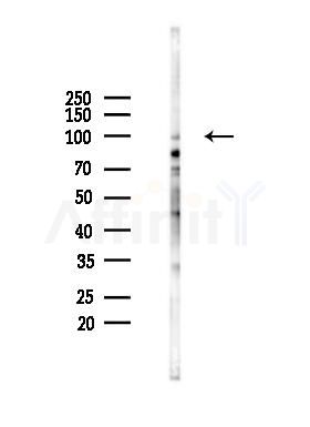 RBM25 Mouse Monoclonal Antibody - Western blot analysis of lysates from B16F10-LUC cells(LPS 4h treatment), using RBM25 Mouse Monoclonal Antibody at 1/1000 dilution.