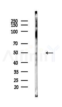 ETS1 Mouse Monoclonal Antibody - Western blot analysis of lysates from COLO205 cells(starvation 24h treatment), using ETS1 Mouse Monoclonal Antibody at 1/1000 dilution.