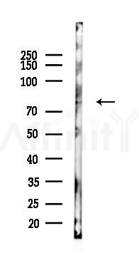 MDM2 Mouse Monoclonal Antibody - Western blot analysis of lysates from COLO205 cells(starvation 24h treatment), using MDM2 Mouse Monoclonal Antibody at 1/1000 dilution.