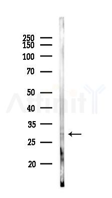 UBE2E3 Antibody - Western blot analysis of lysates from Mouse brain, using UBE2E3 Antibody at 1/1000 dilution.