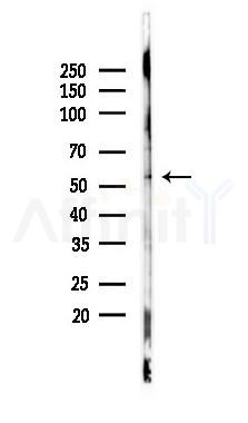 MAGBI Antibody - Western blot analysis of lysates from PC12 cells(heat-shock 45min treatment), using MAGBI Antibody at 1/1000 dilution.