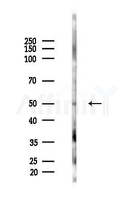 ZNF25 Antibody - Western blot analysis of lysates from 293 cells(UV 30min treatment), using ZNF25 Antibody at 1/1000 dilution.