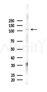 TSH3 Antibody - Western blot analysis of lysates from A2780 cells(starvation 24h treatment), using TSH3 Antibody at 1/1000 dilution.