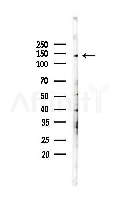 CYFIP1 Antibody - Western blot analysis of lysates from PC12 cells(heat-shock 45min treatment), using CYFIP1 Antibody at 1/1000 dilution.