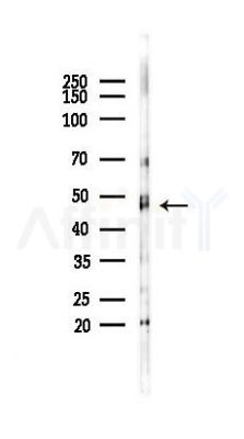 TRMT11 Antibody - Western blot analysis of lysates from Rat liver, using TRMT11 Antibody at 1/1000 dilution.