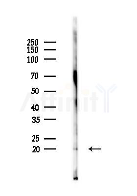 TSC-22R Antibody - Western blot analysis of lysates from Mouse kidney, using TSC-22R Antibody at 1/1000 dilution.