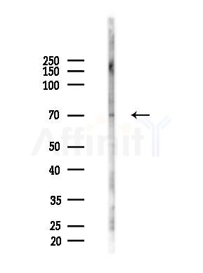CDY1 Antibody - Western blot analysis of lysates from 293 cells(UV 30min treatment), using CDY1 Antibody at 1/1000 dilution.