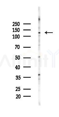 FBF1 Antibody - Western blot analysis of lysates from PC12 cells(starvation 24h treatment), using FBF1 Antibody at 1/1000 dilution.