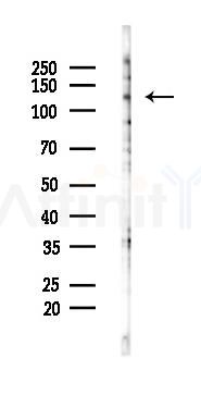 FBF1 Antibody - Western blot analysis of lysates from 293 cells(starvation 24h treatment), using FBF1 Antibody at 1/1000 dilution.