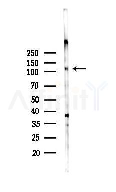 GRIP2 Antibody - Western blot analysis of lysates from 293 cells(heat-shock 45min treatment), using GRIP2 Antibody at 1/1000 dilution.