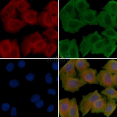 Cytochrome P450 2C9 Antibody - DF10127 staining Hela cells(30min of UV treatment) by IF/ICC.
