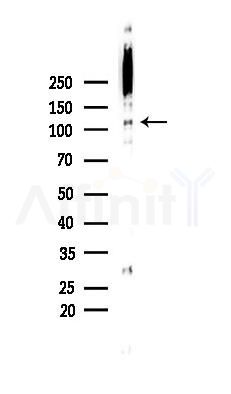NPR2 Antibody - Western blot analysis of lysates from Mouse muscle, using NPR2 Antibody at 1/1000 dilution.