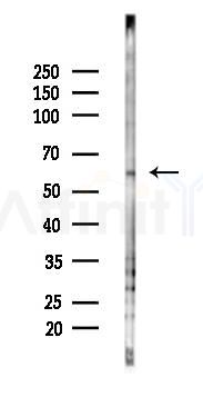 PCTK2 Antibody - Western blot analysis of lysates from PC12 cells(starvation 24h treatment), using PCTK2 Antibody at 1/1000 dilution.