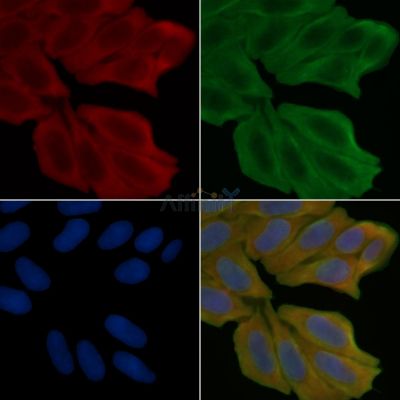 TSSK1 Antibody - DF10144 staining Hela cells(45min of heat-shock treatment) by IF/ICC.